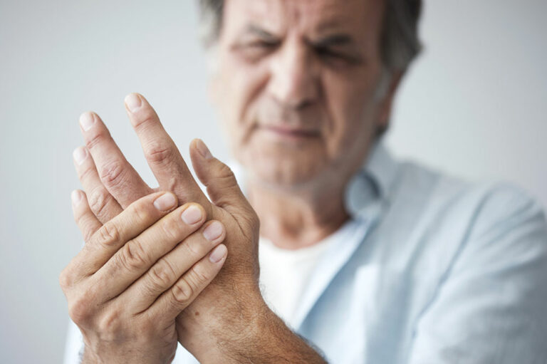 Arthritis &#8211; Types, signs and risk factors