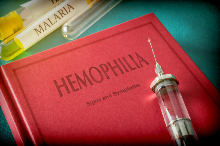 Precautions to take while traveling with hemophilia A