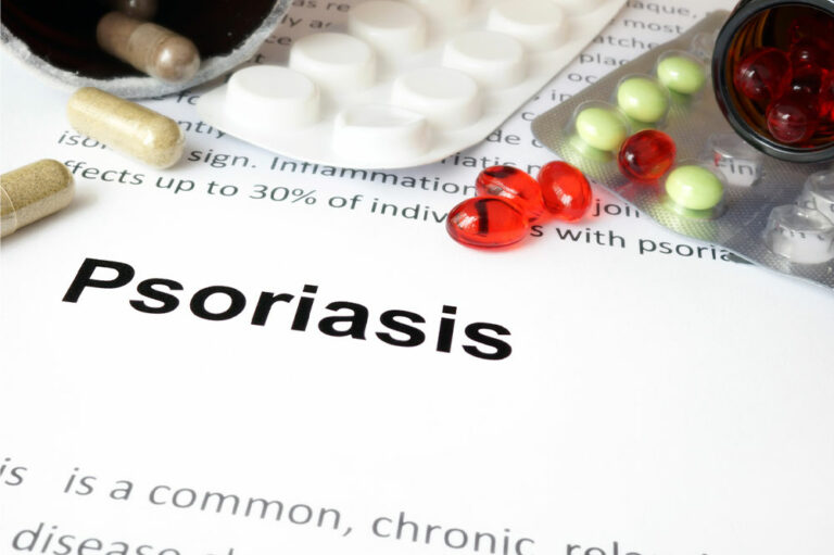 6 common health conditions related to psoriasis