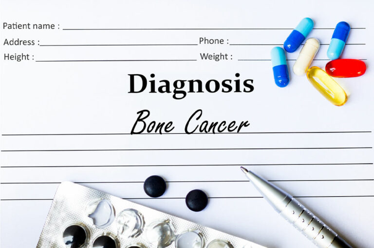 9 warning signs that indicate bone cancer